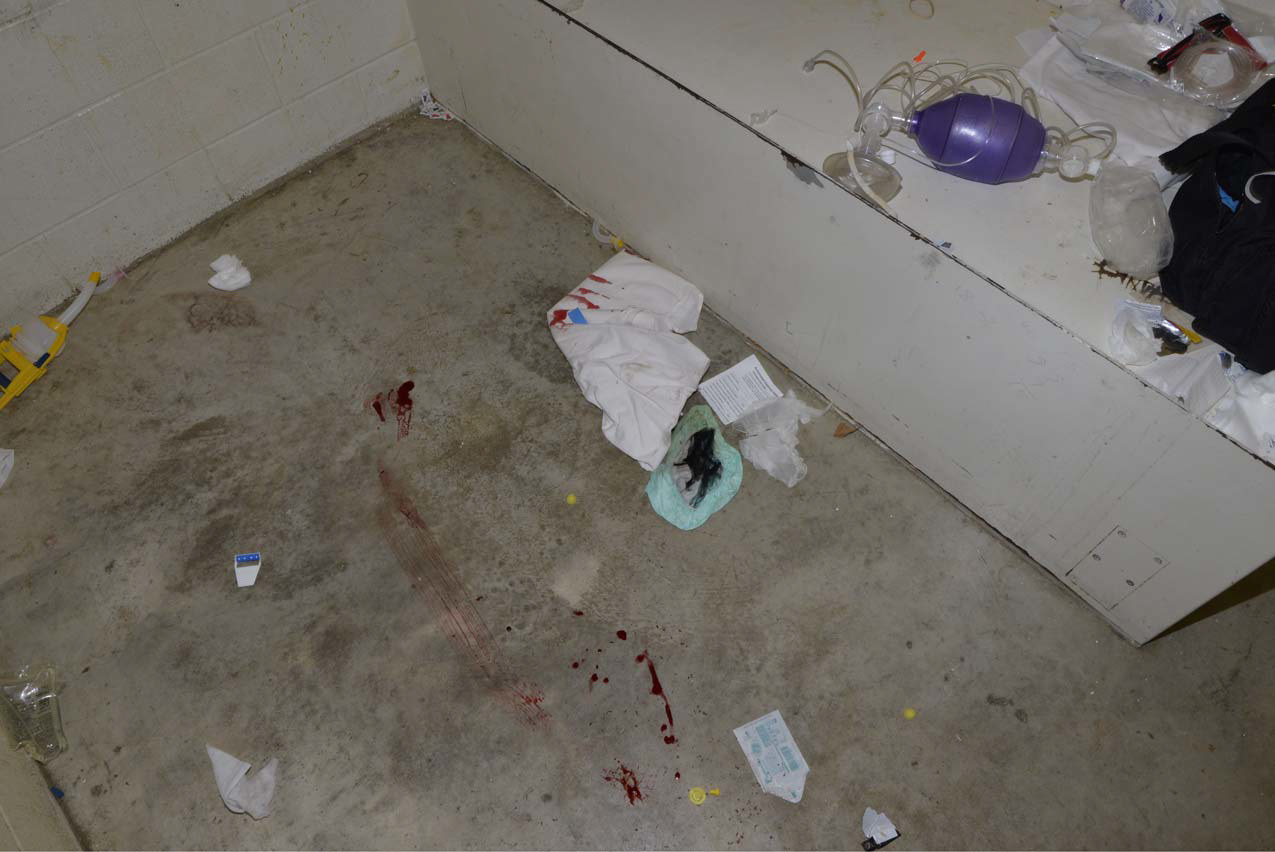 There is no footage of what took place inside the cell. These blood smears were among the hundreds of photos of the scene taken by investigators following Faqiri’s death and obtained by The Fifth Estate. (Kawartha Lakes Police Service)