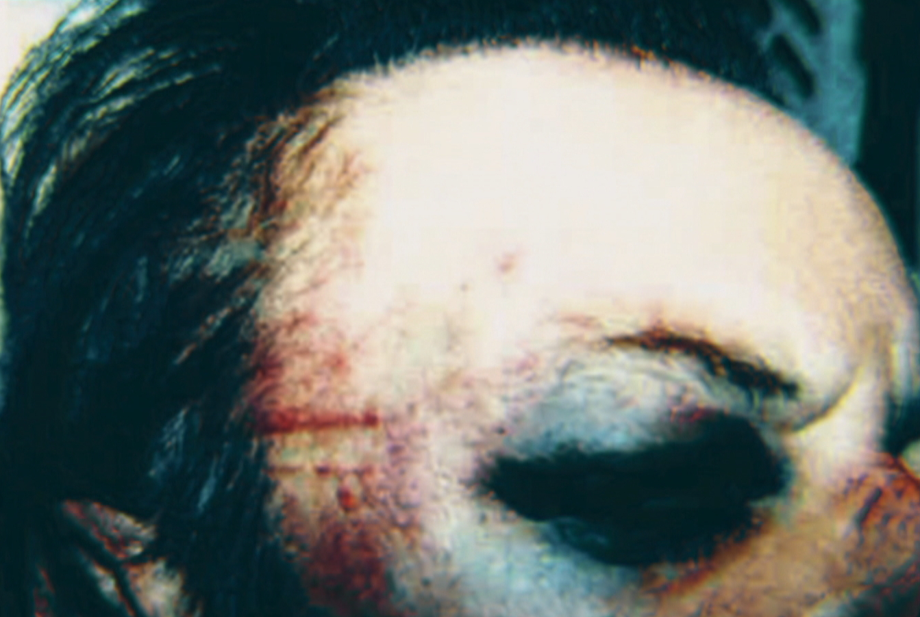 Penner took photos of his injuries after his 2003 arrest. (Submitted by Wayne Penner)